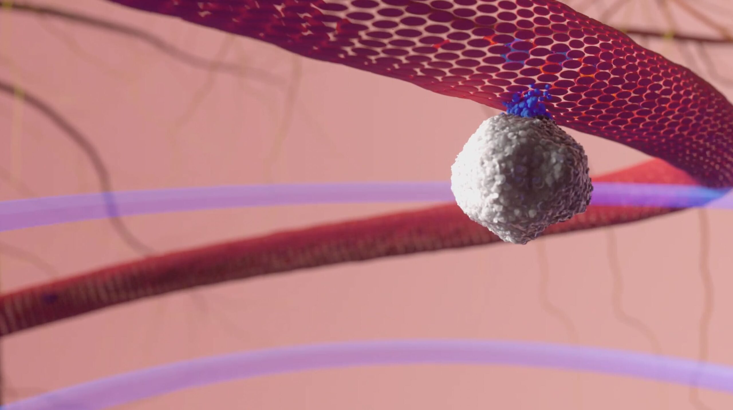 3D model of a tumour